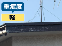 重症度：軽