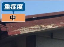 重症度：中